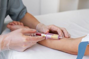 Autohemoterapia 05
