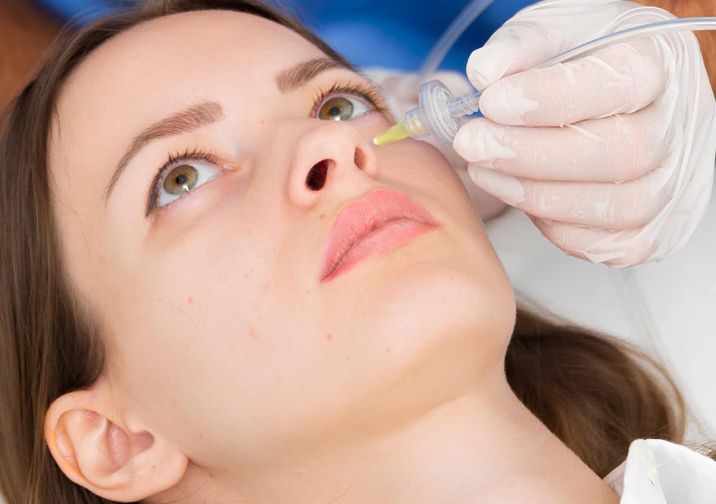 Carboxiterapia facial no invasivo 03