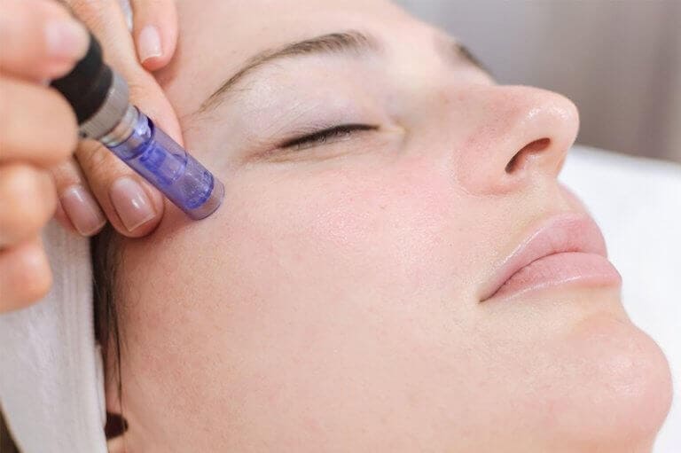 Dermapen 06