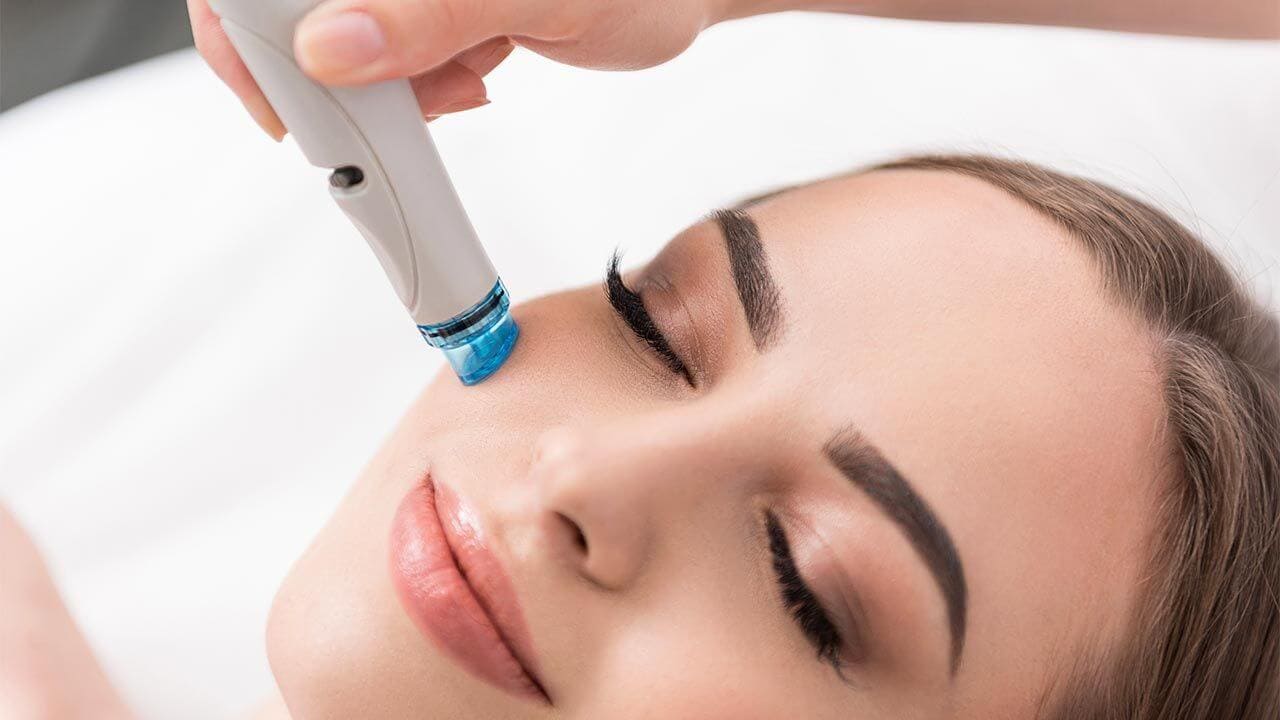 Limpieza facial con punta de diamante 03