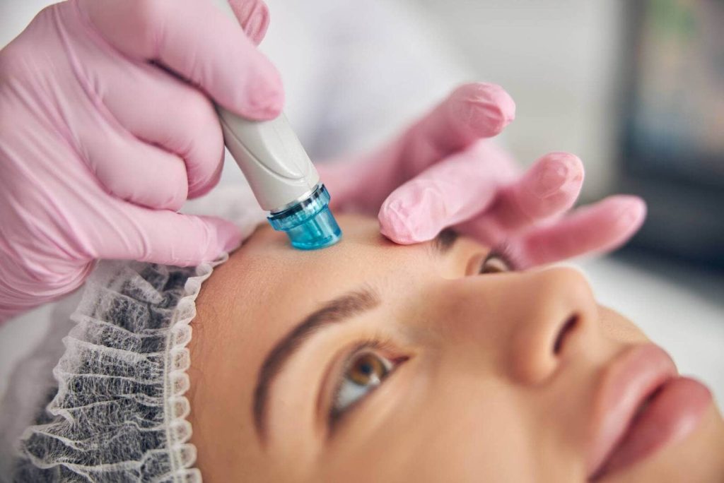 Limpieza facial con punta de diamante 04
