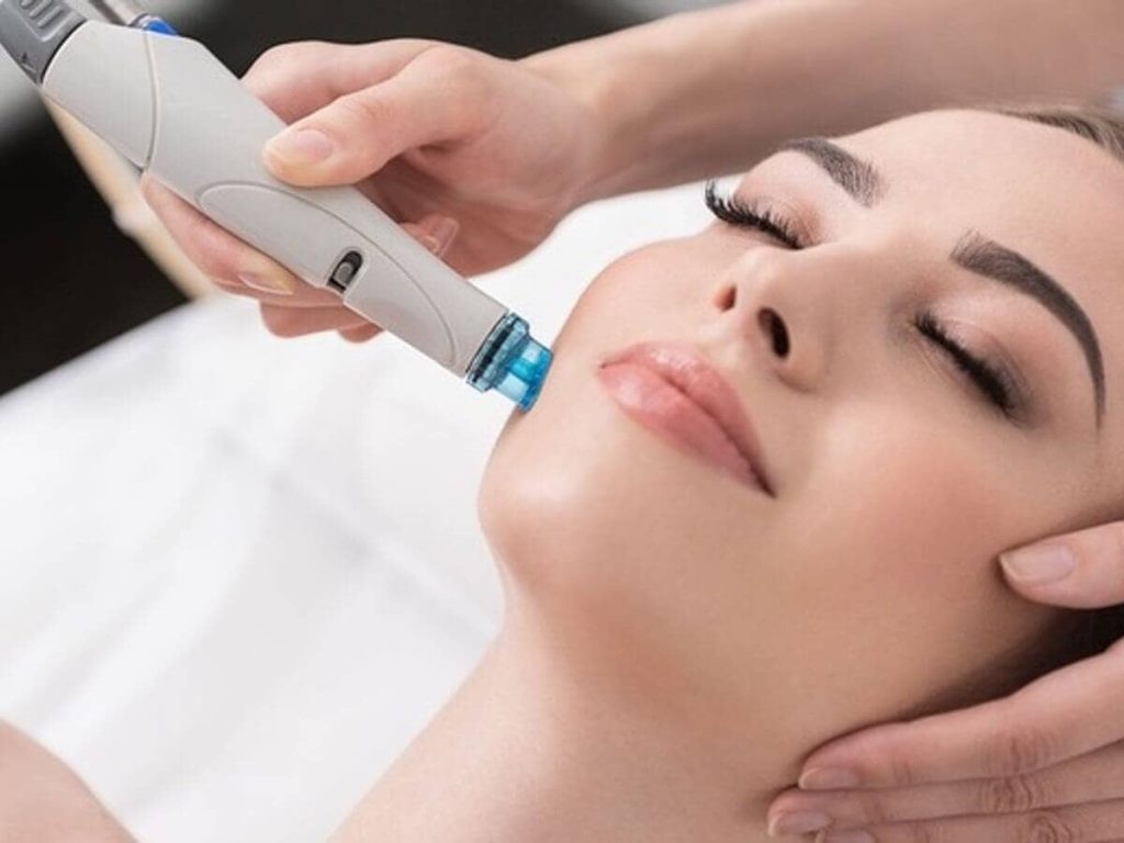 Limpieza facial con punta de diamante 05