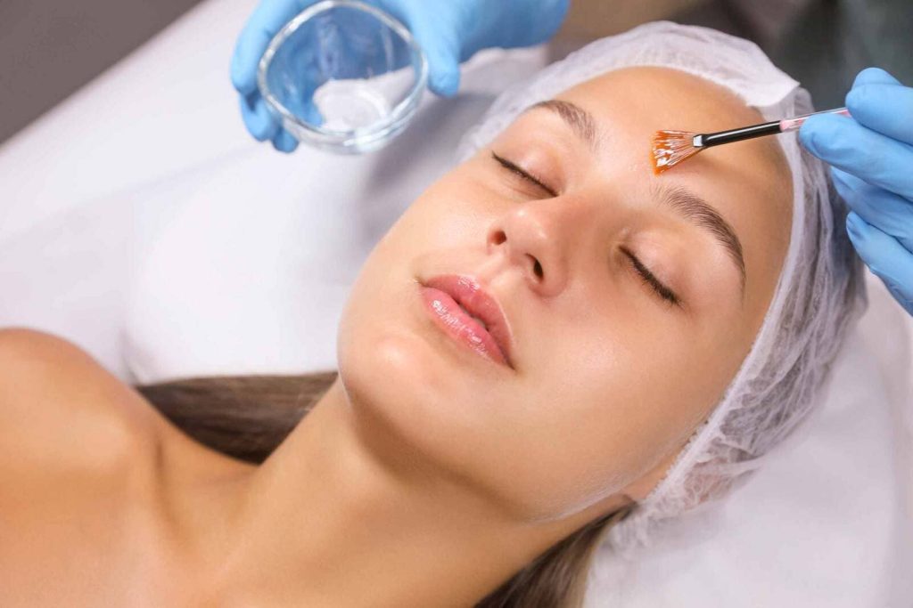 Peeling quimico facial 03