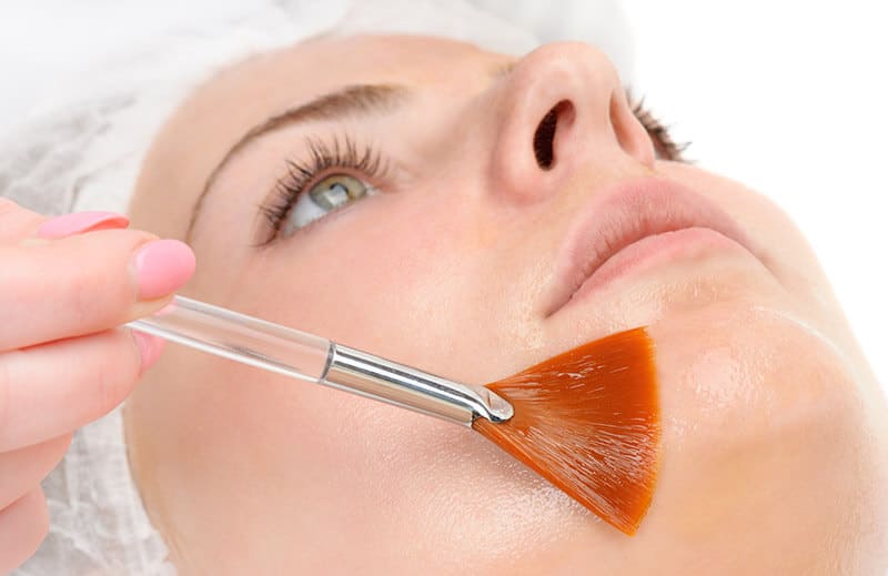 Peeling quimico facial 05